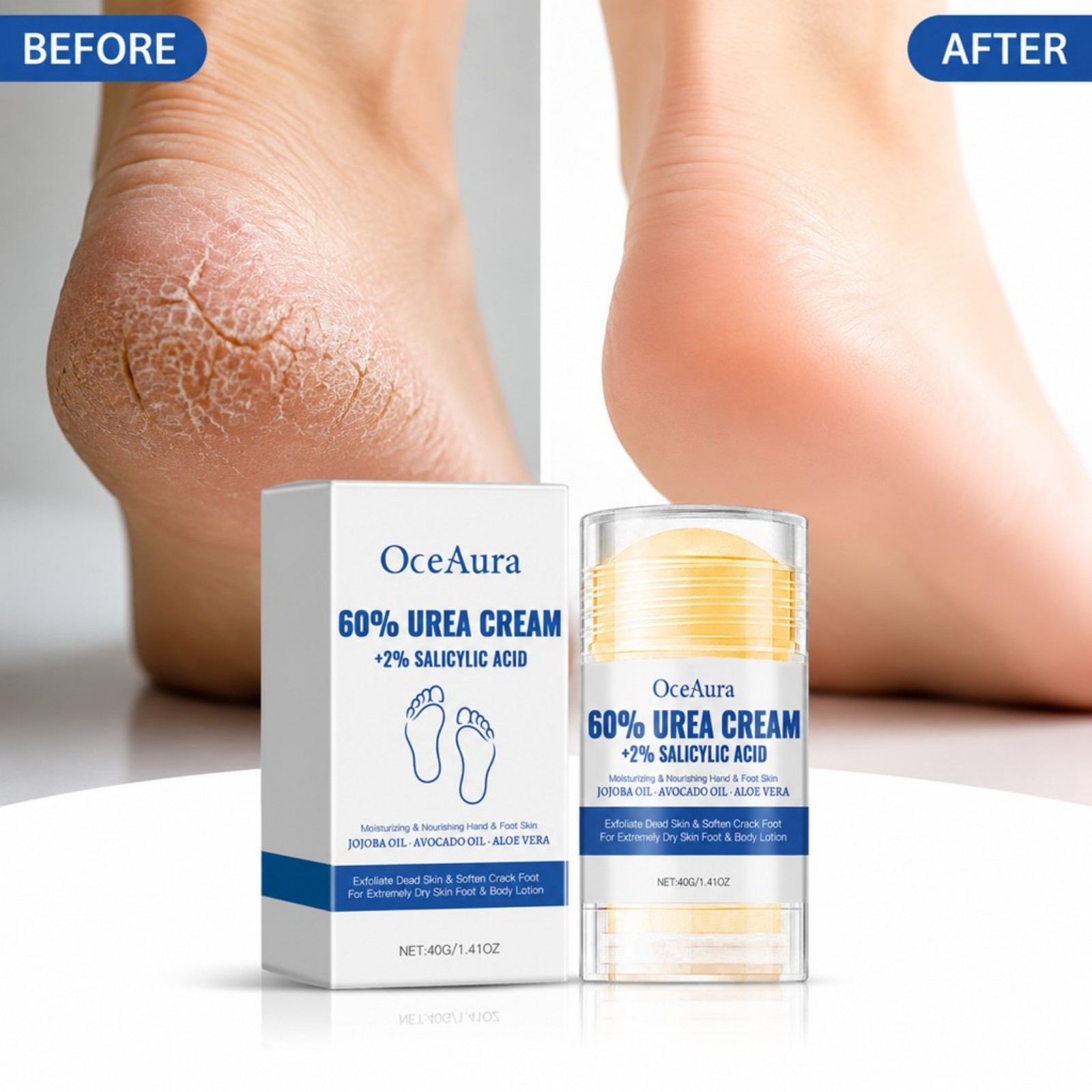 Krim Perawatan Kaki Urea 60% M - Urea Foot Cream ulasan dan harga