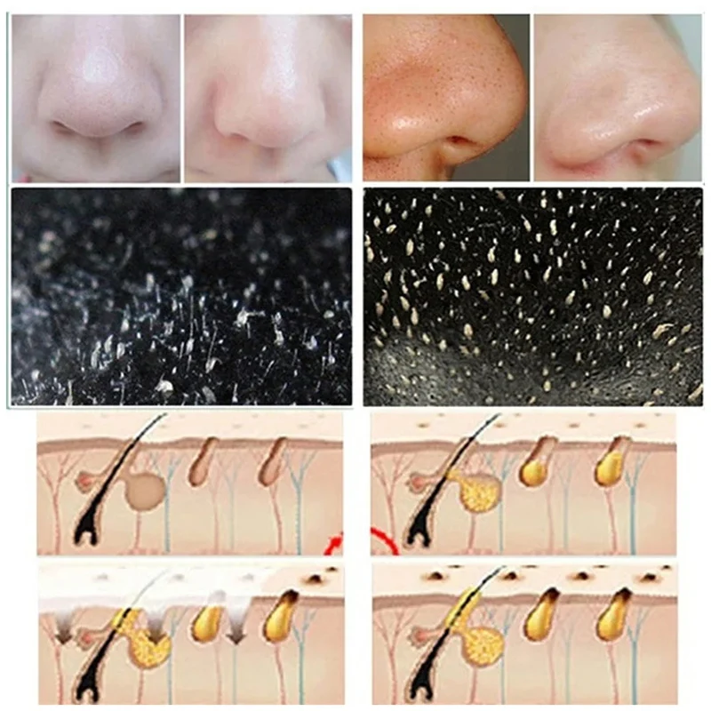10 Buah Strip Hidung Komedo Pe - Cleanser Face ulasan dan harga