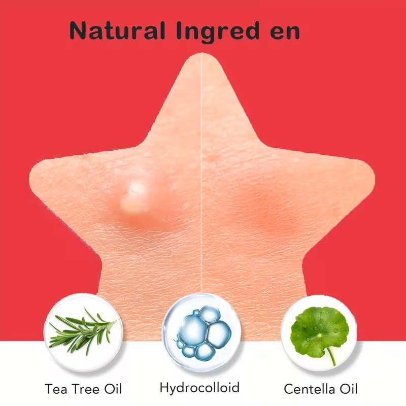 200/400 Buah Tambalan Jerawat  - Face Oil ulasan dan harga
